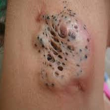 ΦΑΓΕΣΩΡΙΚΟΣ ΣΠΙΛΟΣ